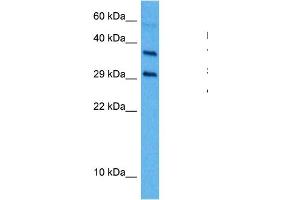 Western Blotting (WB) image for anti-Transforming Growth Factor, beta 1 (TGFB1) (Middle Region) antibody (ABIN2780306)
