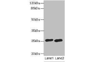 Western blot All lanes: RAB20 antibody at 0.