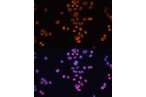 Immunofluorescence analysis of HT-29 cells using CDX2 antibody (ABIN3022281, ABIN3022282, ABIN3022283 and ABIN6218711) at dilution of 1:100. (CDX2 Antikörper  (AA 1-180))