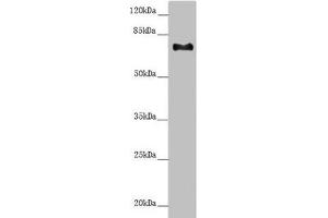 Western blot All lanes: CEP72 antibody at 3. (CEP72 Antikörper  (AA 200-460))