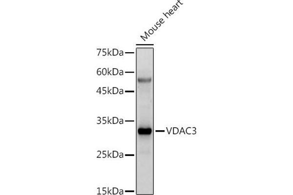 VDAC3 Antikörper  (AA 1-283)