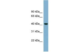 WB Suggested Anti-B4GALT2  Antibody Titration: 0. (B4GALT2 Antikörper  (Middle Region))