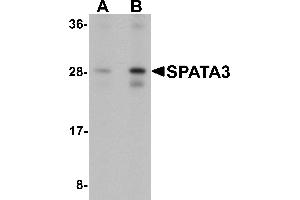 Western Blotting (WB) image for anti-Spermatogenesis Associated 3 (SPATA3) (C-Term) antibody (ABIN1077366) (SPATA3 Antikörper  (C-Term))