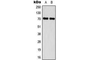 Western blot analysis of Merlin (pS518) expression in MCF7 IFN-treated (A), Jurkat IFN-treated (B) whole cell lysates. (Merlin Antikörper  (C-Term, pSer518))