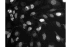 Immunofluorescent staining of HeLa cells. (Topo IIalpha (AA 1245-1361) Antikörper)