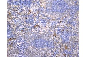 IHC analysis of CD229 using anti-CD229 antibody (ABIN6719290).