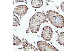 IHC analysis of PEF1 using anti-PEF1 antibody (ABIN6719632).