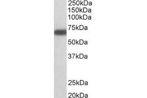Western Blotting (WB) image for anti-Glutamate Decarboxylase 1 (Brain, 67kDa) (GAD1) antibody (ABIN5920040) (GAD Antikörper)