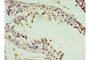 Immunohistochemistry of paraffin-embedded human testis tissue using ABIN7171225 at dilution of 1:100 (Syntaxin 11 Antikörper  (AA 1-287))