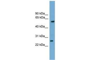 Image no. 1 for anti-Granzyme A (Granzyme 1, Cytotoxic T-Lymphocyte-Associated serine Esterase 3) (GZMA) (C-Term) antibody (ABIN6745578) (GZMA Antikörper  (C-Term))