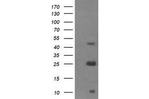 Western Blotting (WB) image for anti-Aldehyde Dehydrogenase 1 Family, Member A3 (ALDH1A3) (AA 1-100), (AA 413-512) antibody (ABIN1490538)