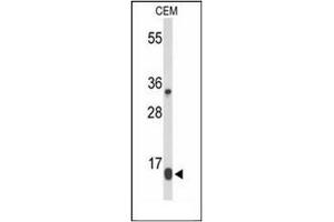 Western blot analysis of DIRAS1 Antibody in CEM cell line lysates (35ug/lane). (DIRAS1 Antikörper  (Middle Region))