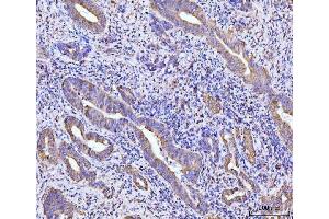 IHC analysis of RPL29 using anti-RPL29 antibody (ABIN7600993). (RPL29 Antikörper  (AA 27-153))