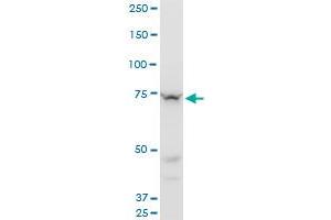 SETX monoclonal antibody (M05), clone 2A9. (Senataxin (SETX) (AA 2579-2676) Antikörper)
