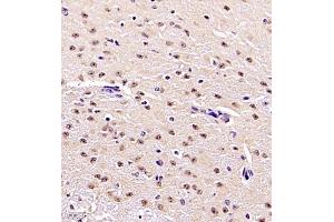 Immunohistochemistry (Paraffin-embedded Sections) (IHC (p)) image for anti-Zinc Finger and SCAN Domain Containing 25 (ZSCAN25) antibody (ABIN7076253)