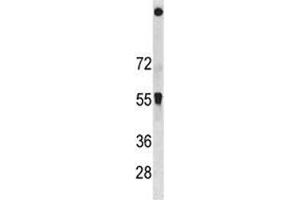 SQSTM1 antibody western blot analysis in HeLa lysate. (SQSTM1 Antikörper  (AA 383-409))