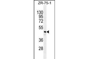 FUT4 Antibody (Center) (ABIN389262 and ABIN2839399) western blot analysis in ZR-75-1 cell line lysates (35 μg/lane). (CD15 Antikörper  (AA 242-271))