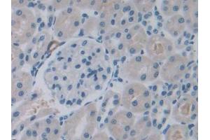 DAB staining on IHC-P; Samples: Rat Kidney Tissue (ROS1 Antikörper  (AA 1937-2210))