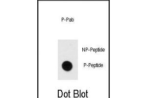 Dot blot analysis of anti-Phospho-MBP- Antibody (ABIN389939 and ABIN2839752) on nitrocellulose membrane. (MBP Antikörper  (pTyr203))