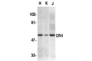Western blot analysis of DR4 in HeLa (H), K562 (K), and Jurkat (J) whole cell lysate with AP30300PU-N DR4 antibody at 1/500 dilution. (TNFRSF10A Antikörper  (N-Term))