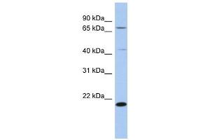 AMD1 antibody used at 1 ug/ml to detect target protein. (AMD1 Antikörper  (N-Term))