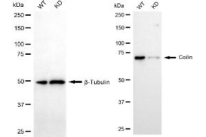 anti-Coilin (COIL) antibody