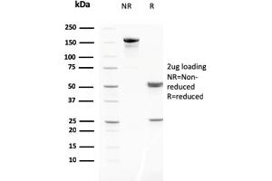 SDS-PAGE (SDS) image for anti-Matrix Metallopeptidase 3 (Stromelysin 1, Progelatinase) (MMP3) (AA 236-363) antibody (ABIN6940072)