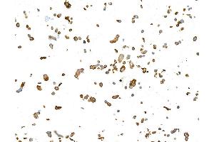 Immunocytochemistry (ICC) image for anti-Keratin 19 (KRT19) antibody (ABIN7449419) (Cytokeratin 19 Antikörper)