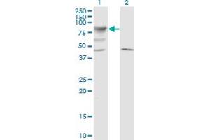 Western Blot analysis of LRRN2 expression in transfected 293T cell line by LRRN5 monoclonal antibody (M01), clone 6A9. (LRRN2 Antikörper  (AA 532-630))