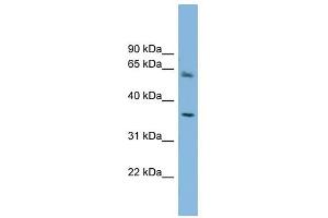 PEX26 antibody used at 1 ug/ml to detect target protein. (PEX26 Antikörper  (Middle Region))