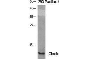 Western Blot (WB) analysis of specific cells using Ghrelin Polyclonal Antibody.