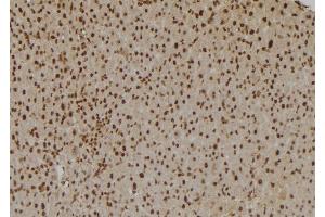 ABIN6275831 at 1/100 staining Rat liver tissue by IHC-P. (TRAF2 Antikörper  (C-Term))