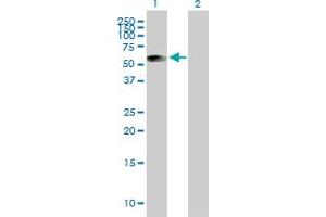Western Blot analysis of ATP5B expression in transfected 293T cell line by ATP5B MaxPab polyclonal antibody. (ATP5B Antikörper  (AA 1-529))