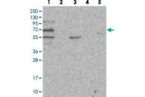 Western blot analysis of Lane 1: RT-4, Lane 2: U-251 MG, Lane 3: Human Plasma, Lane 4: Liver, Lane 5: Tonsil with SOWAHB polyclonal antibody . (SOWAHB Antikörper)