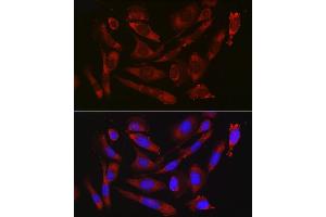 Immunofluorescence (IF) image for anti-CD47 (CD47) (AA 20-140) antibody (ABIN3022624)