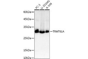 Western blot analysis of extracts of various cell lines, using TRMT61A antibody (ABIN6132806, ABIN6149558, ABIN6149559 and ABIN6214904) at 1:1000 dilution. (TRMT61A Antikörper  (AA 1-289))