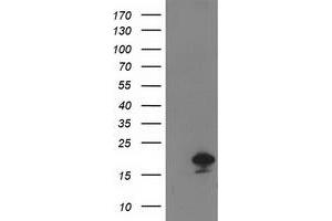 HEK293T cells were transfected with the pCMV6-ENTRY control (Left lane) or pCMV6-ENTRY DSTN (Right lane) cDNA for 48 hrs and lysed. (Destrin Antikörper)