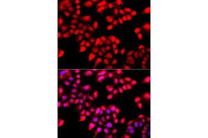 Immunofluorescence analysis of A549 cells using XRCC6 antibody.