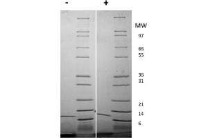 SDS-PAGE of Mouse Interleukin-13 Recombinant Protein SDS-PAGE of Mouse Interleukin-13 Recombinant Protein. (IL-13 Protein)