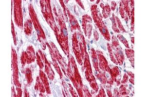 Anti-COX6B1 antibody IHC of human heart.