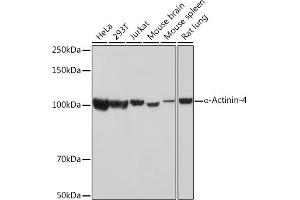 Western blot analysis of extracts of various cell lines, using α-Actinin-4 Rabbit mAb (ABIN7265399) at 1:1000 dilution.