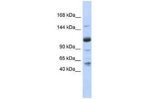WB Suggested Anti-SR140 Antibody Titration:  0. (SR140 Antikörper  (N-Term))