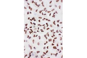 Anti-Ku70 antibody, ICC ICC: A549 Cell