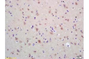 Formalin-fixed and paraffin embedded rat brain labeled with Rabbit Anti HSP60 Polyclonal Antibody, Unconjugated (ABIN726080) at 1:200 followed by conjugation to the secondary antibody and DAB staining