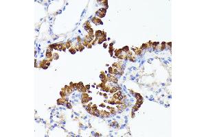 Immunohistochemistry of paraffin-embedded mouse lung using SMYD4 antibody (ABIN6133038, ABIN6148171, ABIN6148172 and ABIN6223147) at dilution of 1:100 (40x lens). (SMYD4 Antikörper  (AA 1-260))