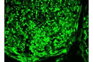 Immunofluorescent staining of human ES cell line. (TRA1-60 Antikörper)