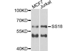 Western blot analysis of extracts of MCF7 and Jurkat cells, using SS18 antibody. (SS18 Antikörper)
