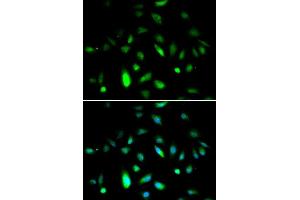 Immunofluorescence analysis of A549 cell using CCNB1 antibody. (Cyclin B1 Antikörper  (C-Term))