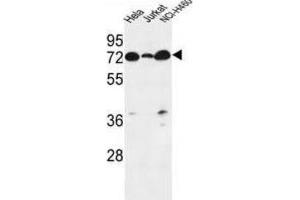 Western Blotting (WB) image for anti-Lipid Phosphate Phosphatase-Related Protein Type 4 (LPPR4) antibody (ABIN3002187)