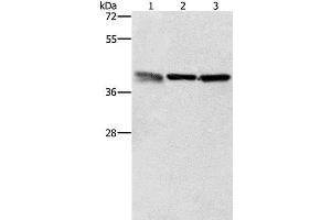 Western Blot analysis of A549, K562 and PC3 cell using ZFP42 Polyclonal Antibody at dilution of 1:500 (ZFP42 Antikörper)